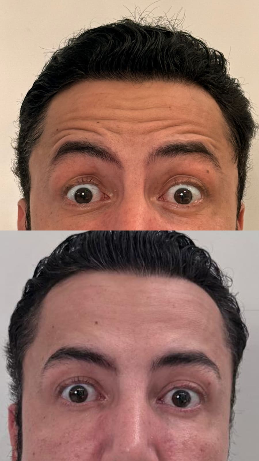 Registro de um caso de harmonização orofacial